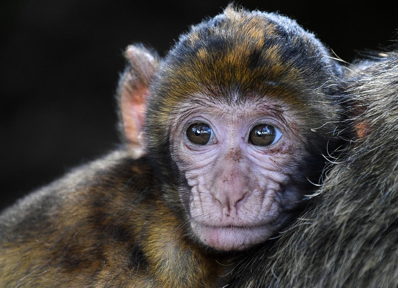 Monkeypox Is Not Yet A Health Emergency -Says WHO