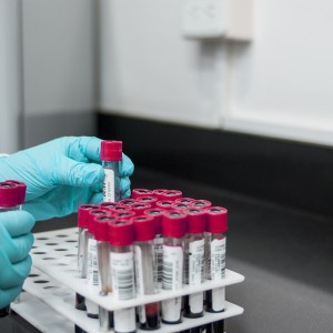 Lab-Grown Blood Given To Humans In World-First Trial