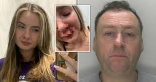 Girl, 19, Had Her Face Bitten off by Stranger on a Bus in Front of Passengers